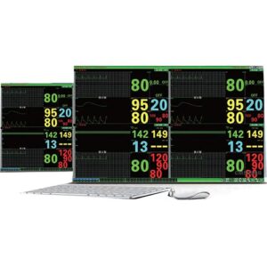 Central de Surveillance Pour Moniteur