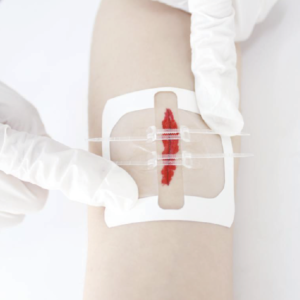 Pansement de sutures 7 x 6 cm