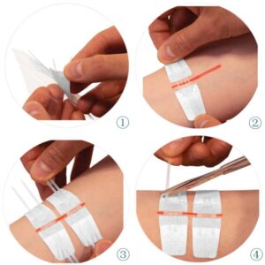 Pansement de sutures 8 x 2 cm
